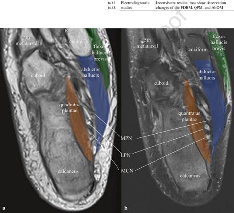 Abductor hallucis, flexor digitorium brevis, abductor digiti minimi 2nd layer: 11 Axial MRI images of the foot. (a) T1-weighted image; (b ...
