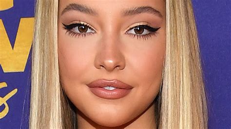 The Strange Tiktok Trend To Achieve Lips Like Madelyn Cline