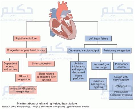 left vs right sided heart failure Heart Failure حكيم Nurse