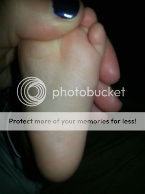 Black Spot On Foot Pic Included Babycenter