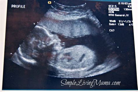 20 Week Ultrasound Simple Living Mama