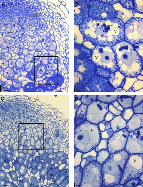 The central vacuole is a large membraned sac in the cytoplasm that holds water and keeps plants from wilting. Silencing of VPS39 Disturbs the Formation of the Central ...