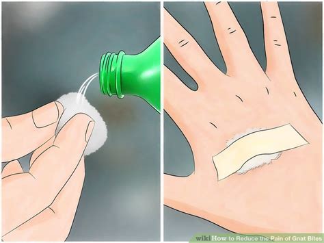 3 Ways To Reduce The Pain Of Gnat Bites Wikihow