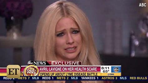 Avril Lavigne On Lyme Disease Battle The Worst Time In My Life La