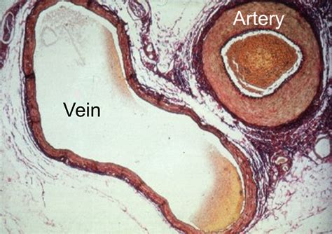 Labeled Artery And Vein Microscope Micropedia