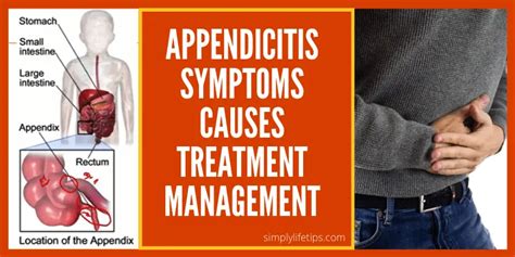 Appendicitis Signs And Symptoms