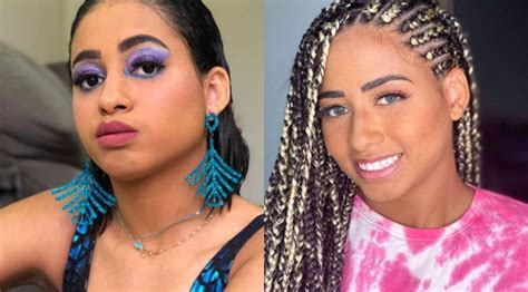 Confira o antes e depois dos famosos que fizeram harmonização facial