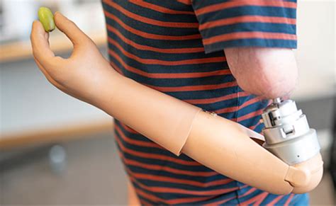 Mind-controlled arm prostheses that 'feel' are now a part of everyday