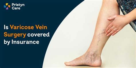 Varicose Veins Archives Pristyn Care
