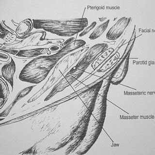 Auditory ossicles xương nhỏ thính giác. (PDF) Masseteric-Facial Nerve Anastomosis: Case Report