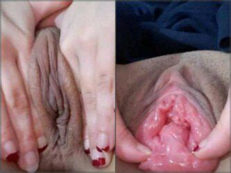 Vaginal Loose Vixenxmoon Show Her Big Pussy Prolapse Very Closeup Webcam