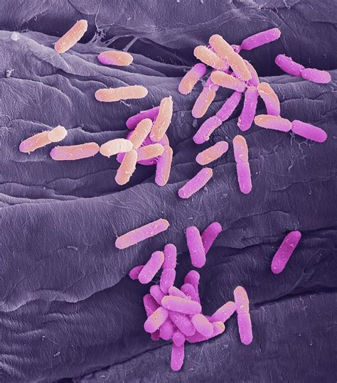E Coli Bacteria Photograph By Steve Gschmeissner Pixels