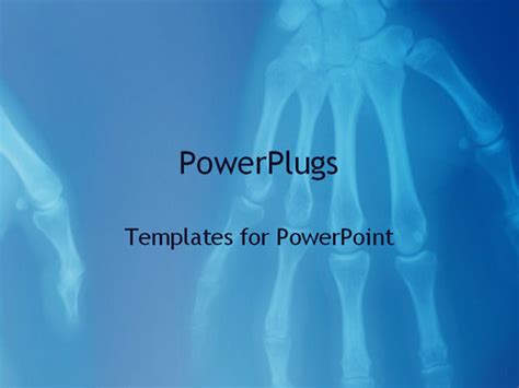 X Ray Powerpoint Template Background Of X Ray Bones Medicine Tr0207