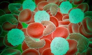 The daily dilemmas of a student with sickle cell anaemia ...