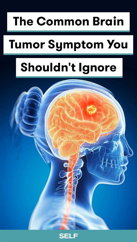 Brain tumors may be primary tumors, in which case they originate in the brain or secondary tumors that have spread to the brain from cancer elsewhere the tumor grows slowly and does not usually spread. The Common Brain Tumor Symptom You Shouldn't Ignore ...