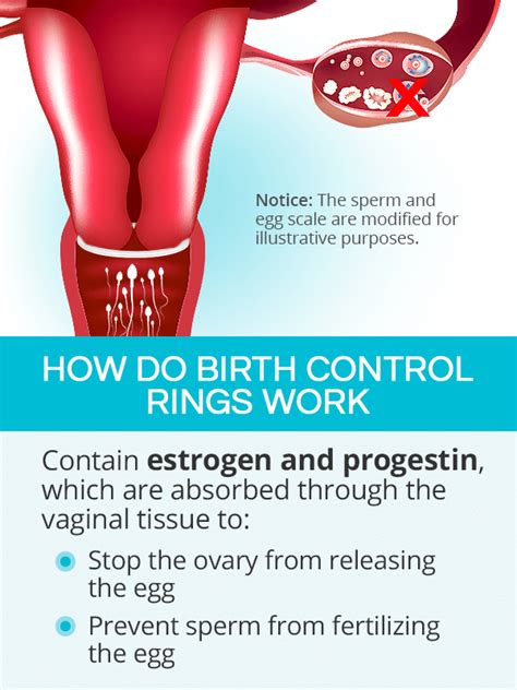 Birth Control Rings Shecares
