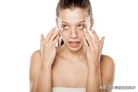 緩解眼疲的辦法有多種，常用的就是採用眼藥水，那麼眼貼有用嗎？ 每日頭條