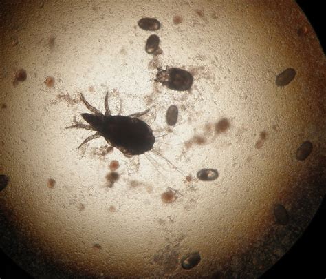Procurada pela jovem pan, a assessoria de comunicação do órgão não soube informar se a suspeita foi confirmada. ATLAS MICOLOGIA: ÁCARO CONTAMINANTE