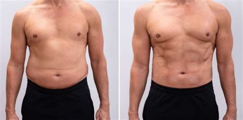How To Lose Belly Fat For Men 12 Simple Tips Backed By Science Name