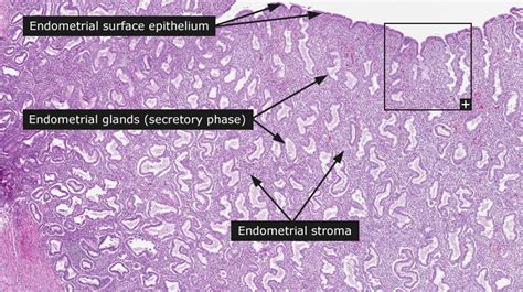 Dictionary Normal Endometrium The Human Protein Atlas
