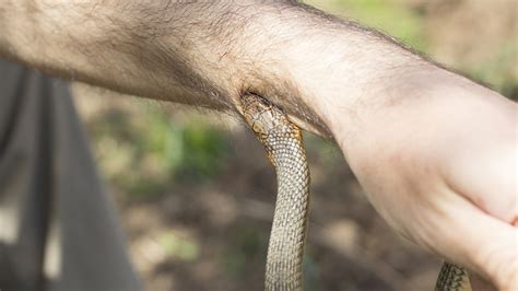 Venomous Snake Bites