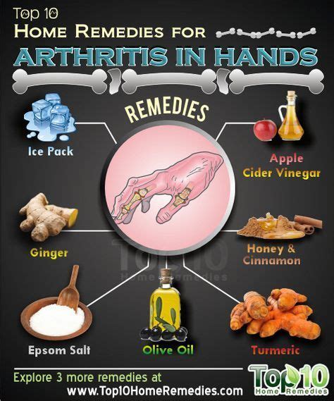 Top 10 Home Remedies For Arthritis Arthritis Hands Natural Cure For