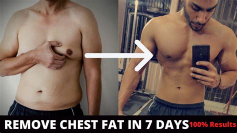 Remove Chest Fat In Days How To Reduce Chest Fat Top Excercise For Chest Fat