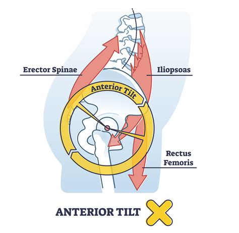 Kettlebell Swing Lower Back Pain Possible Reasons Inspire US