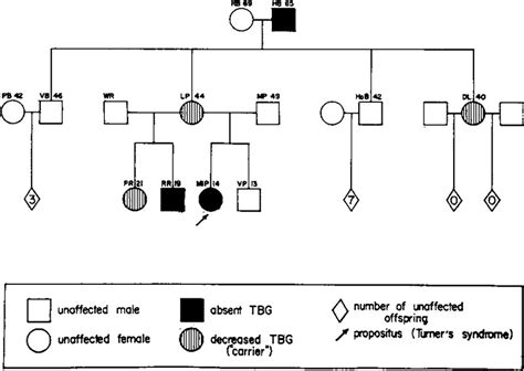 Familial Thyroxine Binding Globulin Deficiency In A Patient With Turner