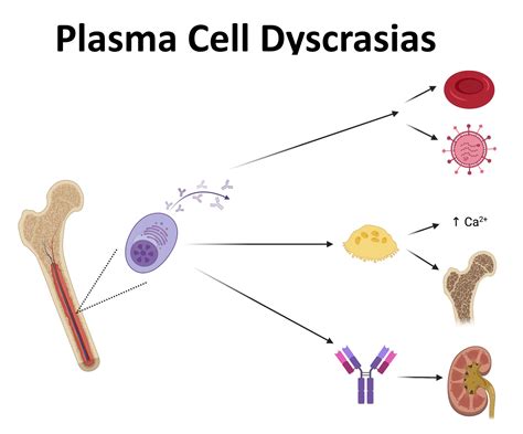 Plasma Cell Dyscrasias Teachim