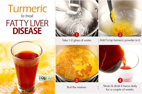 Home Remedies For Fatty Liver Disease Top 10 Home Remedies