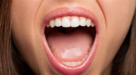 Oral Cavity Cancer O Kanser Sa Bibig Mga Senyales At Sintomas Ritemed
