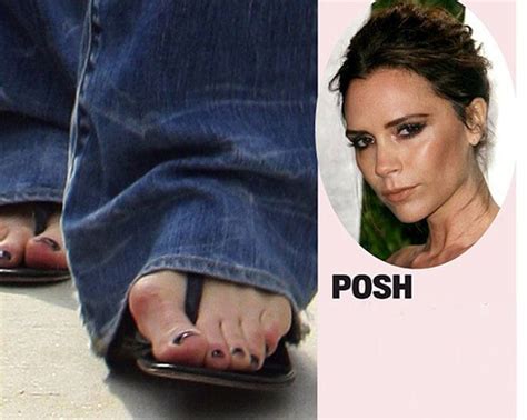Celebrities With Ugly Feet 15 Pics