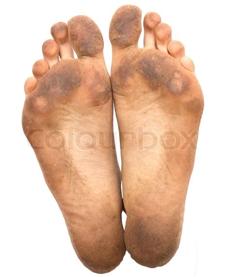 Dirty Foot On A White Background Stock Image Colourbox