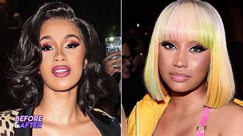 Nicki Minaj Plastic Surgery Tips For Getting Cosmetic Surgery
