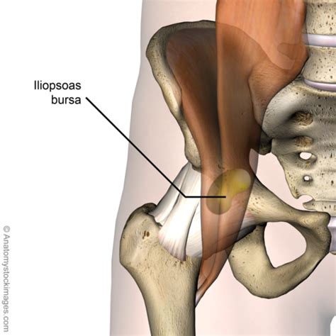 Hip Pain Back Pain Hip Dysplasia Hip Replacement Bursitis Post Op Alternative Health Body