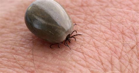 Warning Over Lyme Disease Prevalence In Southwest The Irish Times