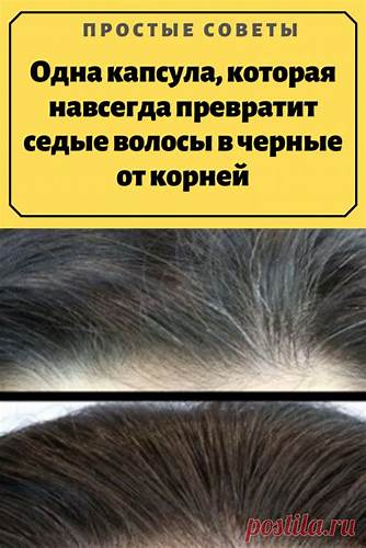 От диеты выпадают волосы