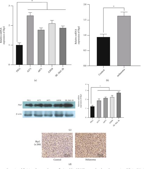 [pdf] mir 590 5p targets skp2 to inhibit the growth and invasion of malignant melanoma cells
