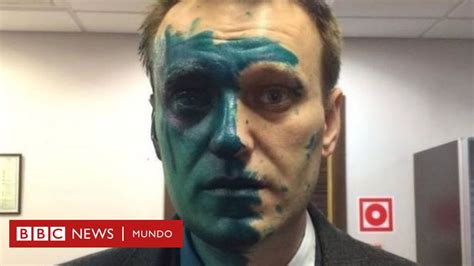 quién es alexei navalny el mayor crítico de putin en rusia y que está hospitalizado de gravedad