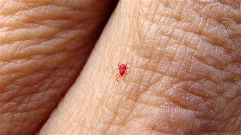Spider Mite Bites On Humans Spider Mites Do Not Bite Human Beings And