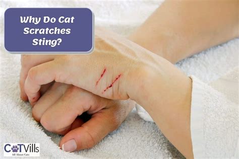 Why Do Cat Scratches Sting 5 Reasons And How To Treat Them