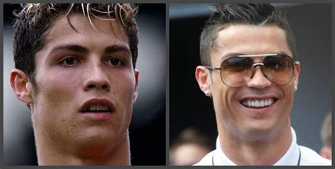 Cristiano Ronaldo Before After