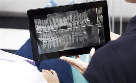 Radiología Dental Clínica La Marina