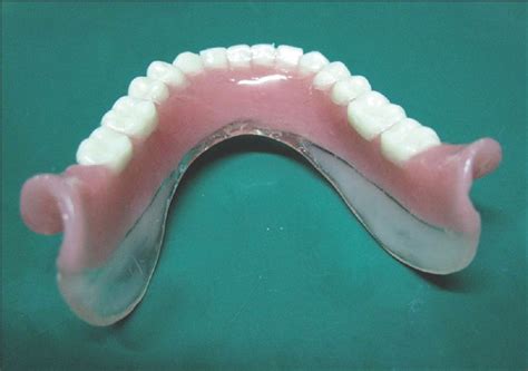 Parts Of Complete Denture Dr Nechupadam Dental Clinic