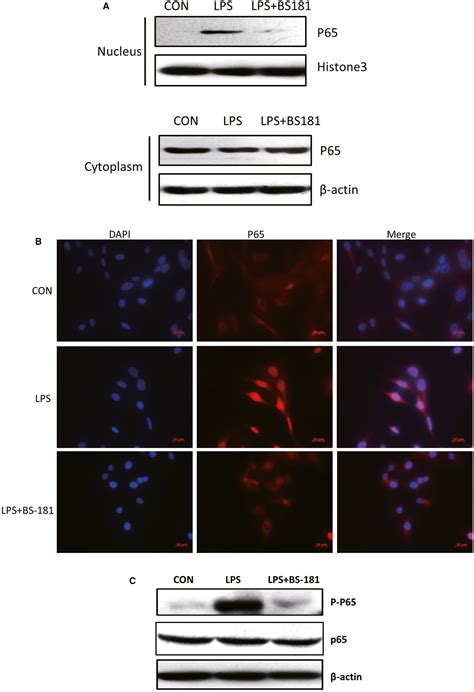 Cdk7 Inhibition Suppresses Rheumatoid Arthritis Inflammation Via