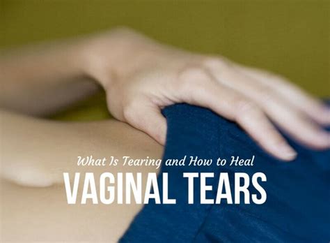 What Is Tearing And How To Heal Vaginal Tears Baby Care Mag