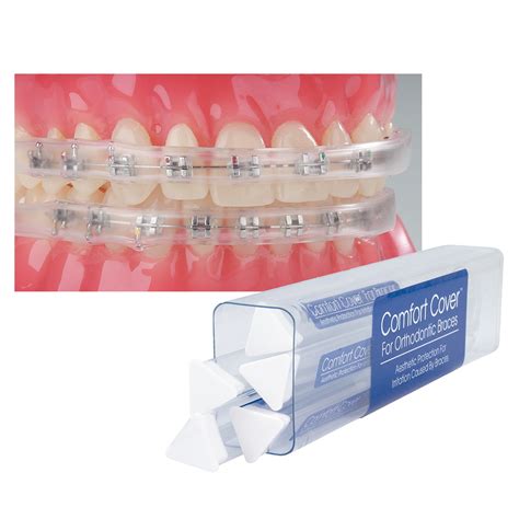 Unfortunately, not all plans automatically come with this level of coverage. Comfort Cover for Braces - Ortho Technology