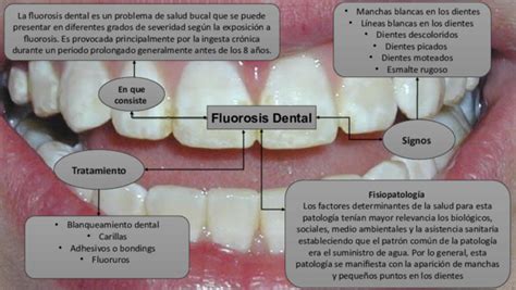 Ppt Fluorosis Dental Nayer Andi