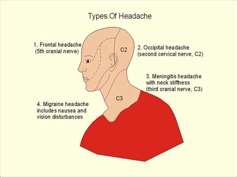 270535headache Location Meaning Frontal